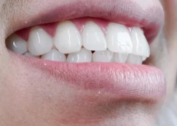 Reabilitação oral e estética dental: entenda os benefícios dos tratamentos que transformam saúde e autoestima