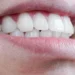 Reabilitação oral e estética dental: entenda os benefícios dos tratamentos que transformam saúde e autoestima